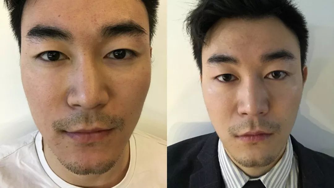 坚持美白全身,坚持做什么可以美白