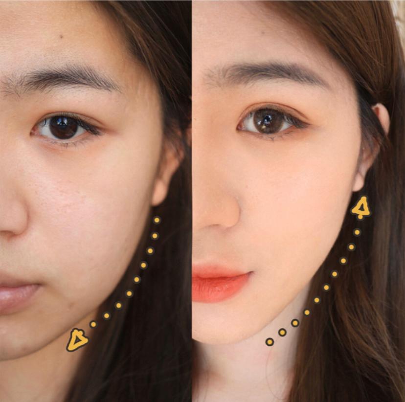 瘦脸小v脸的方法,每天张嘴闭嘴100下能瘦脸吗