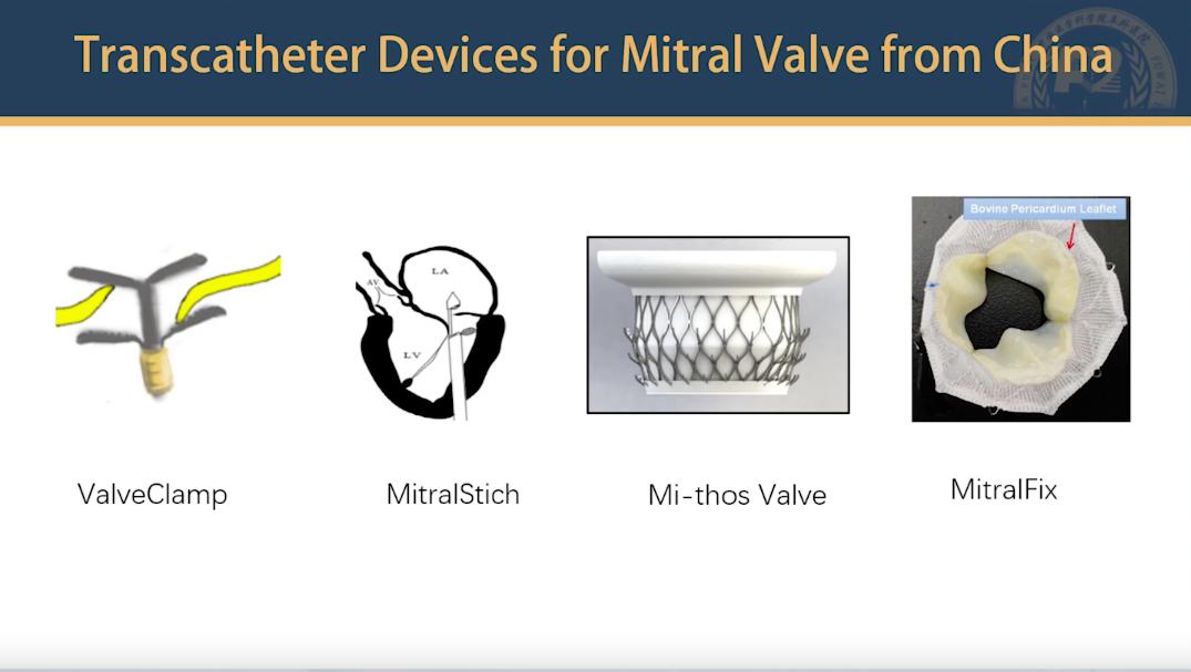 结构性心脏病诊疗的现状怎么样,随着技术的发展心脏的介入治疗
