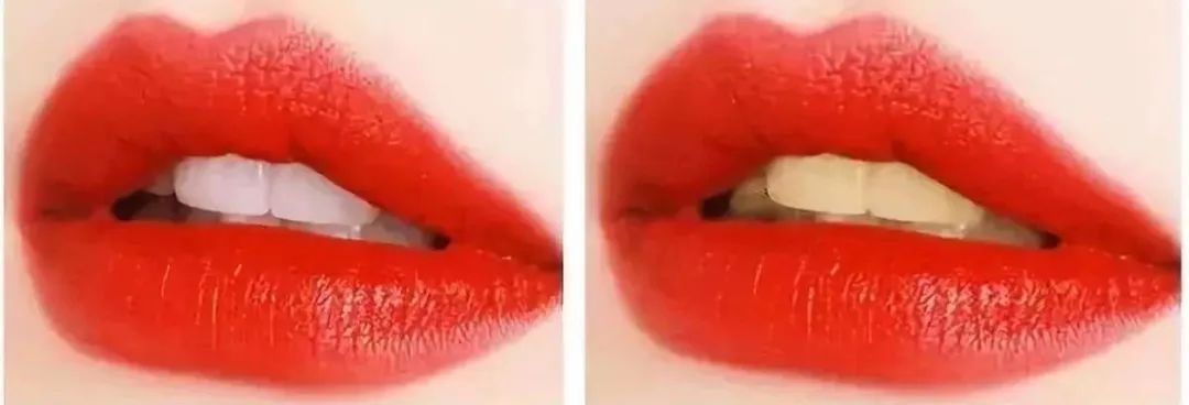 牙齿太黄简单的方法不用花钱,牙齿黄除了洗牙还有什么办法