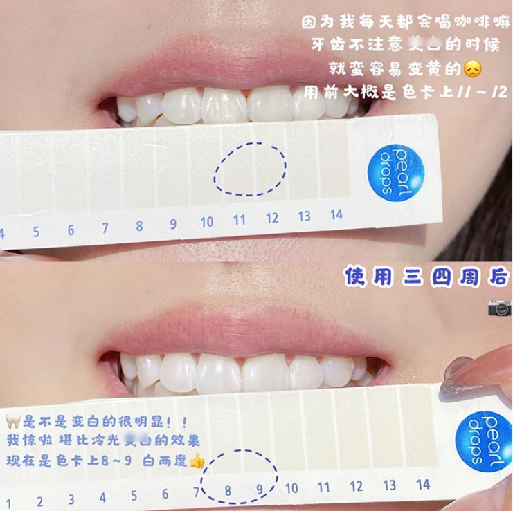 牙齿太黄简单的方法不用花钱,牙齿黄除了洗牙还有什么办法