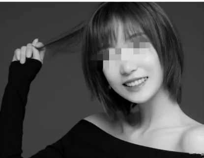 昆明龅牙矫正哪家便宜,长沙成人隐形牙齿矫正龅牙