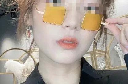 昆明龅牙矫正哪家便宜,长沙成人隐形牙齿矫正龅牙