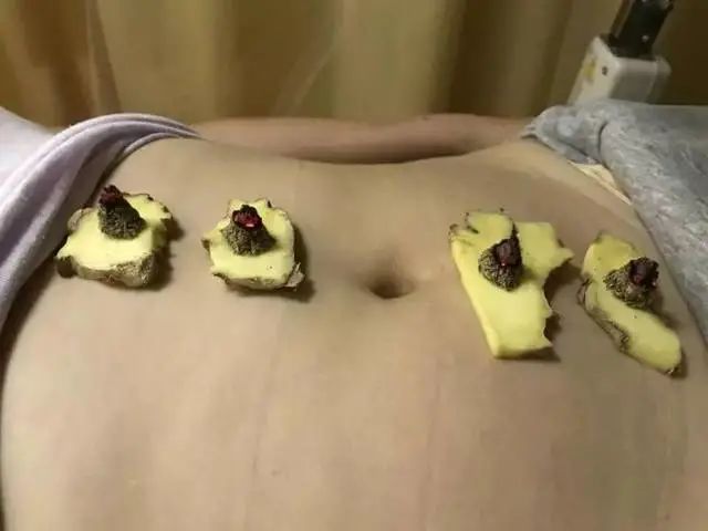 暖肚子的小妙招,如何暖胃暖肚子