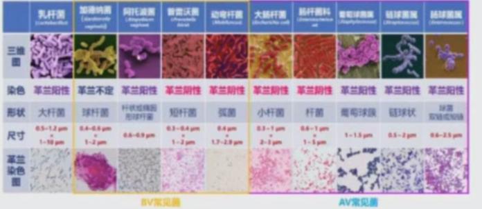 阴道这个江湖，乱了就麻烦了