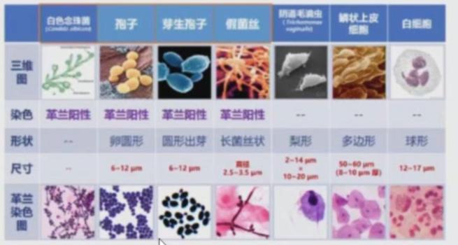 阴道这个江湖，乱了就麻烦了