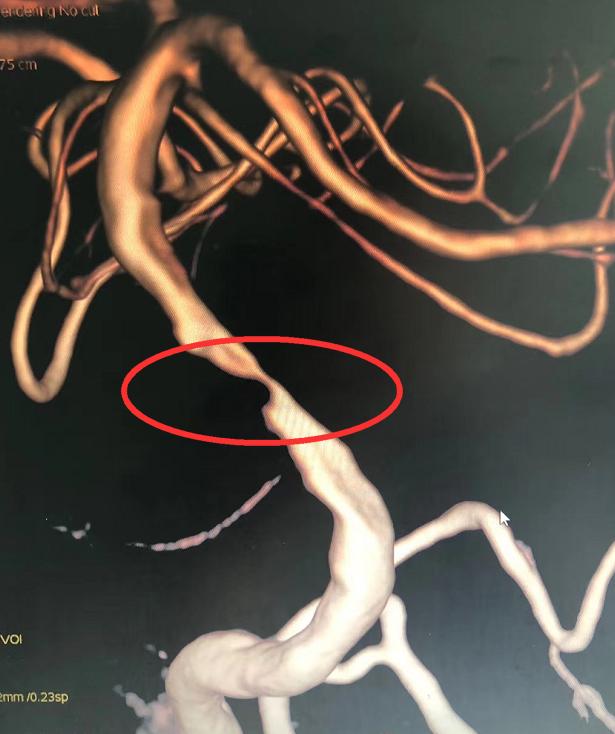 身体发出各种求救信号急需要休息,身体发出的求救信号知道了能救命