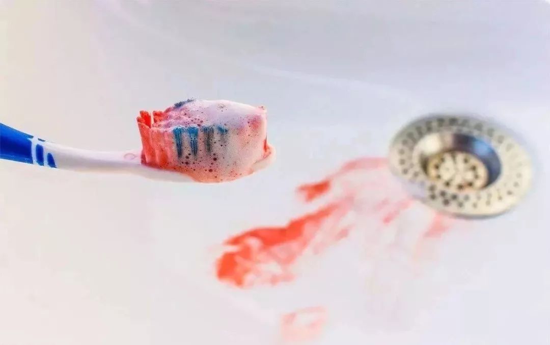 便宜哭了！日本人都在用的变态牙刷，竟然比洗牙还白，牙垢、牙龈出血全解决，嘴巴里脏东西洗出来后，太清爽了
