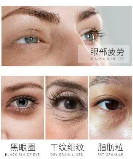 秘籍|夏季夜生活主角掰头，赌Ta稳赢