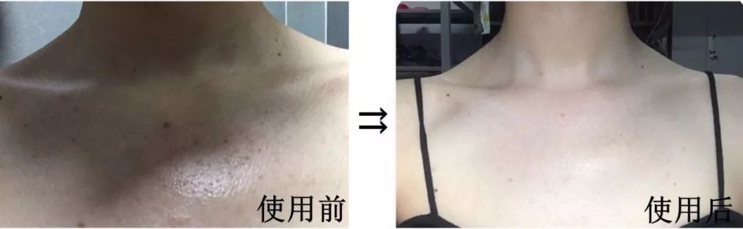 适合夏天用的沐浴露有哪些,夏天用什么沐浴露清爽又香