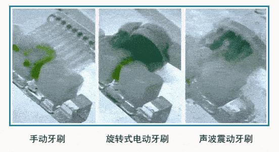 小红书电动牙刷,70元左右电动牙刷