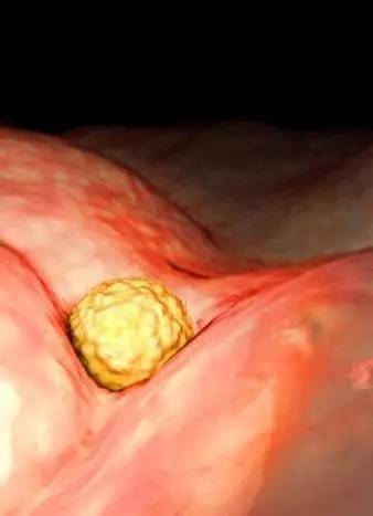 宝宝在子宫会无聊吗？看看胎儿在子宫内都干些什么