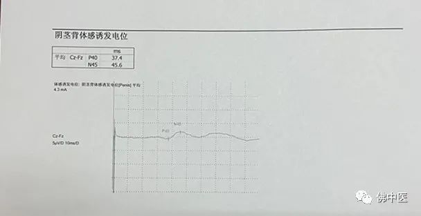 【七夕】佛中医新上线“男神”检查,解决你的“男”言之隐