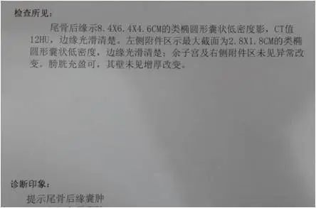 骶管囊肿有多大的危害怎么能治愈,骶管囊肿严重了最坏的可能是什么