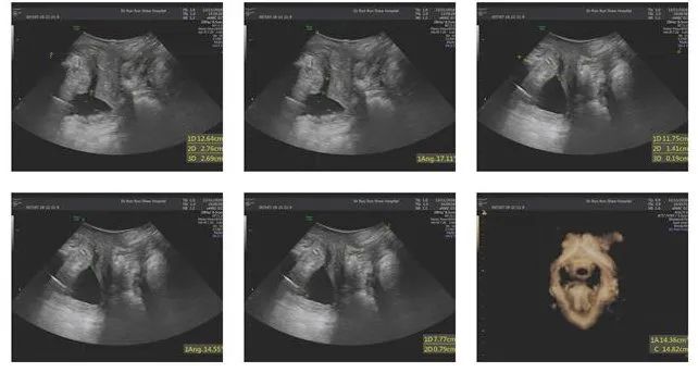 生完小孩多可怕,生完孩子后最可怕的是什么