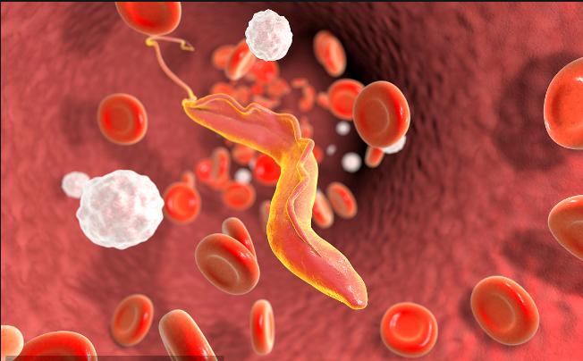 51岁老刘臀部包块不断长大，华山感染专家：是非洲来的“偷渡客”