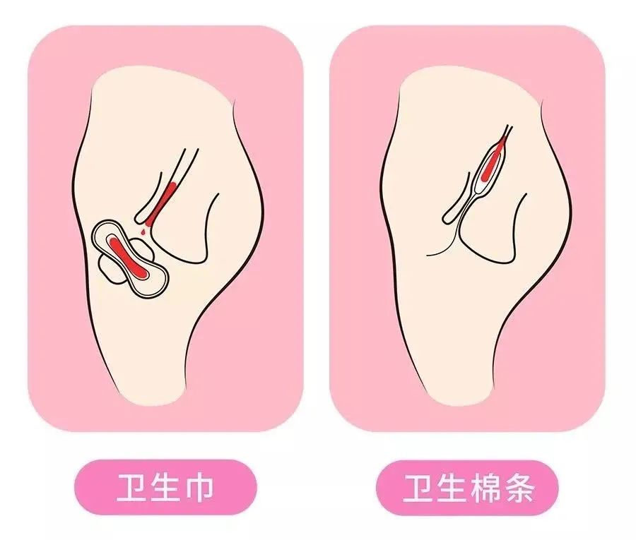 生理期姨妈巾好用推荐,姨妈期很好用的姨妈巾