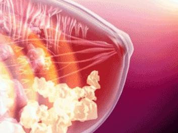 怎么丰胸安全又见效快不用吃药,丰胸除了按摩有什么方法
