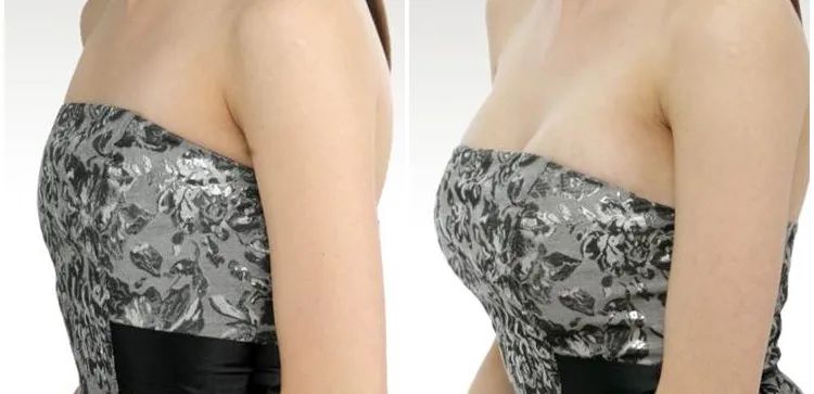 怎么丰胸安全又见效快不用吃药,丰胸除了按摩有什么方法