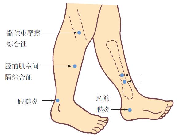 下肢神经损伤的十大症状,下肢损伤图片