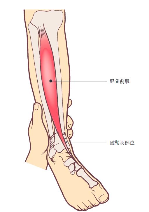 下肢神经损伤的十大症状,下肢损伤图片