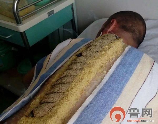 淄博市中心医院中医科:返璞归真弘扬国粹中医中药护佑健康