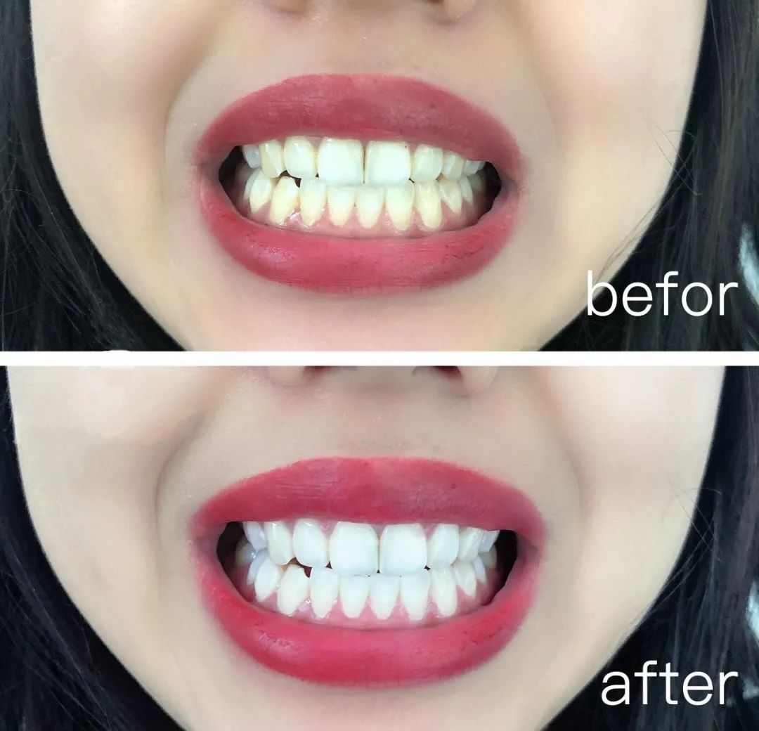 牙粉去烟渍牙结石牙膏排名第一名,美白牙膏推荐去牙黄老牌子