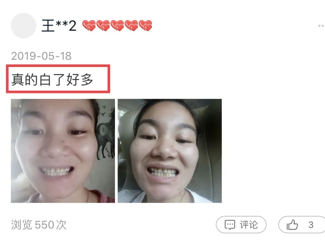 牙粉去烟渍牙结石牙膏排名第一名,美白牙膏推荐去牙黄老牌子