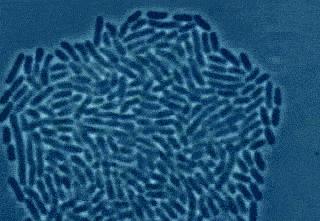 【吃惊】女子胸“跑到”腰上去了！还发生严重感染，注射过的女性赶紧注意了……