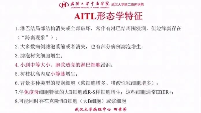 nkt细胞淋巴瘤第四期治疗病例,nkt细胞淋巴瘤第四期