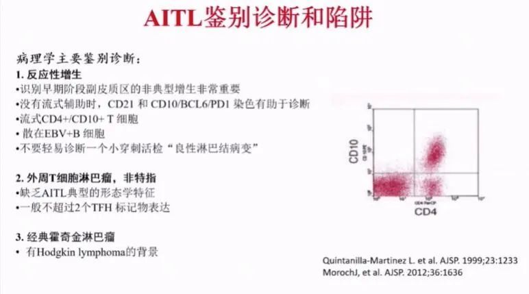 nkt细胞淋巴瘤第四期治疗病例,nkt细胞淋巴瘤第四期
