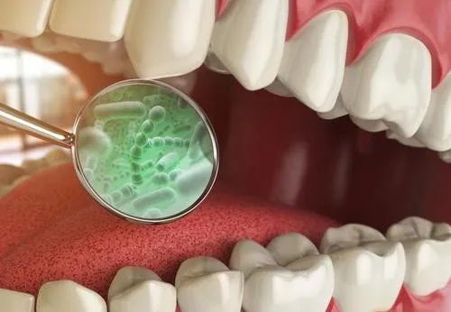 用这款神奇的专利牙膏刷一刷，3分钟KO细菌，老牙垢瞬间溶解，老黄牙不见了，多年的口臭都消失了，牙医强烈安利