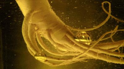 60岁没眼袋方法,教你一招去眼纹