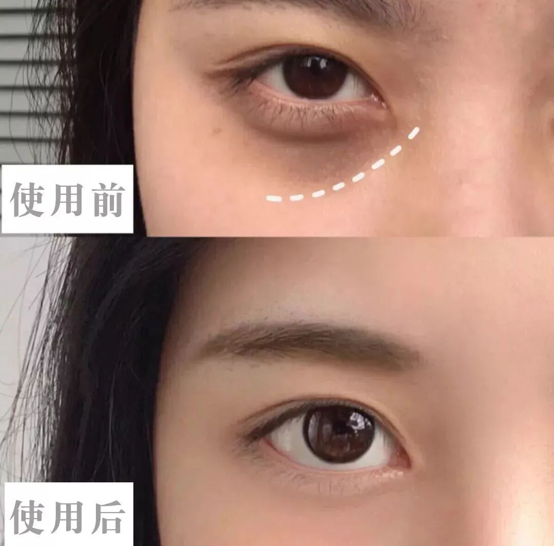 60岁没眼袋方法,教你一招去眼纹