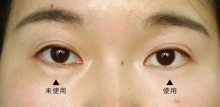 60岁没眼袋方法,教你一招去眼纹