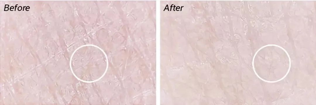60岁没眼袋方法,教你一招去眼纹