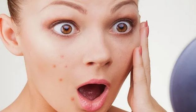 挤青春痘导致颅内感染症状,挤痘痘引发感染休克