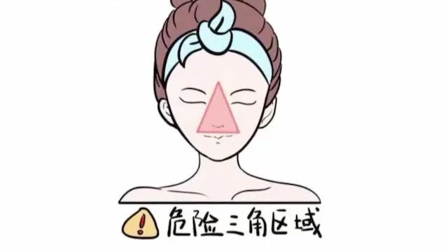 挤青春痘导致颅内感染症状,挤痘痘引发感染休克