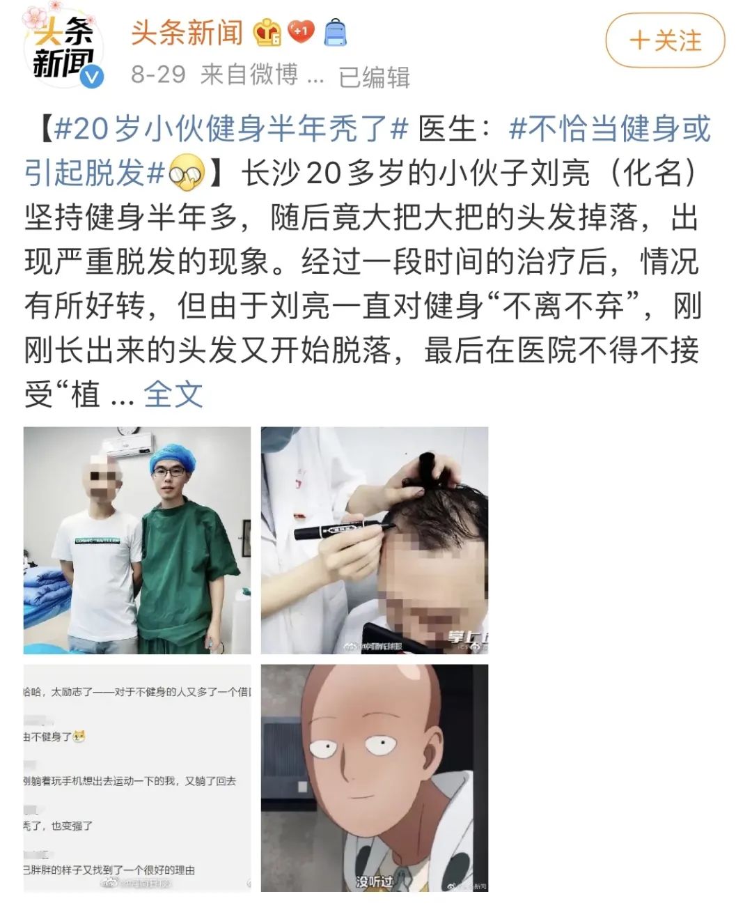 20岁脱发秃头能恢复吗,健身真的会脱发秃头吗