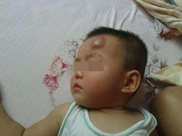 宝宝磕到头时家长应该怎么做,宝宝磕到头了怎么处理