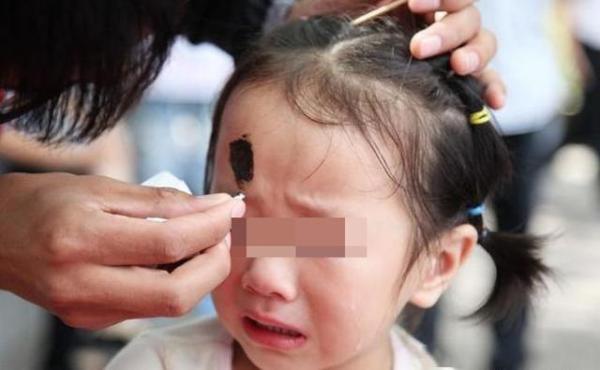 宝宝磕到头时家长应该怎么做,宝宝磕到头了怎么处理