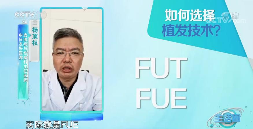 用什么洗发水防止脱发断发,洗头发时加点它防止脱发