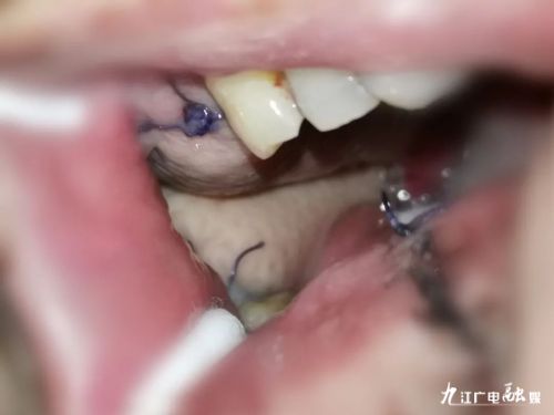 生命活水集团项目,生命活水集团