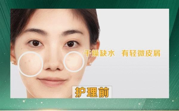 【全国4000店通用｜樊文花丨38元享门市价388元套餐，AI专业肌肤检测+面部深度清洁+面部拨筋+基础补水。卢氏有店