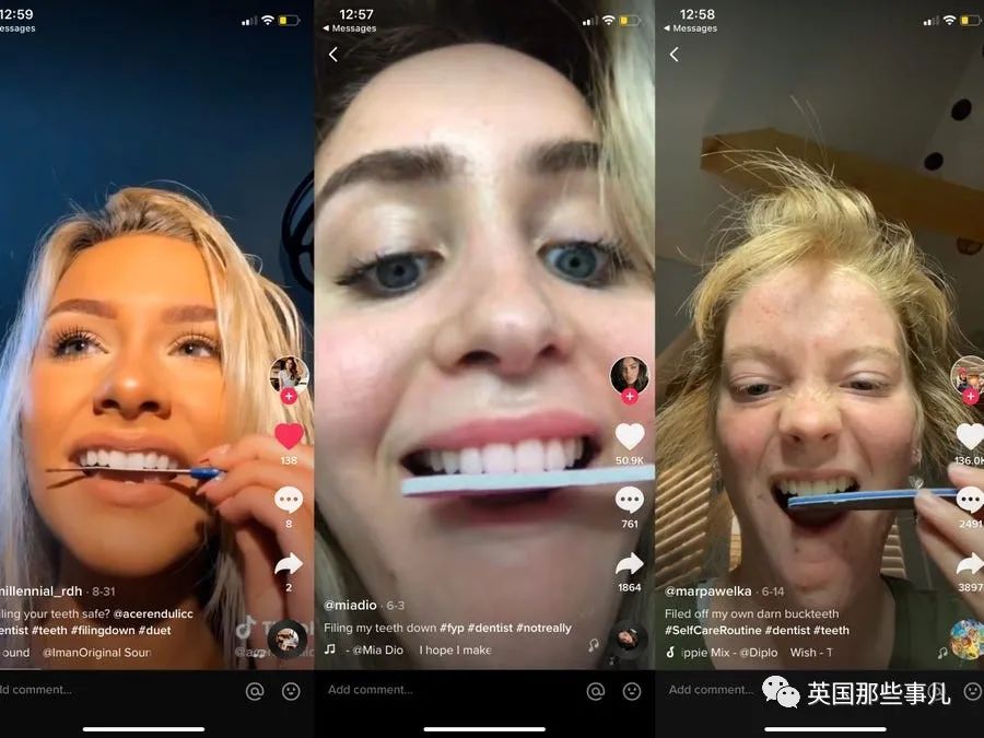 外网年轻人流行用指甲锉磨牙正畸，把正经牙医都急坏了