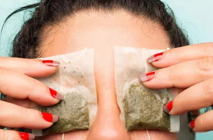 黑眼圈严重者早睡早起最好防范,黑眼圈是身体非常严重的警告