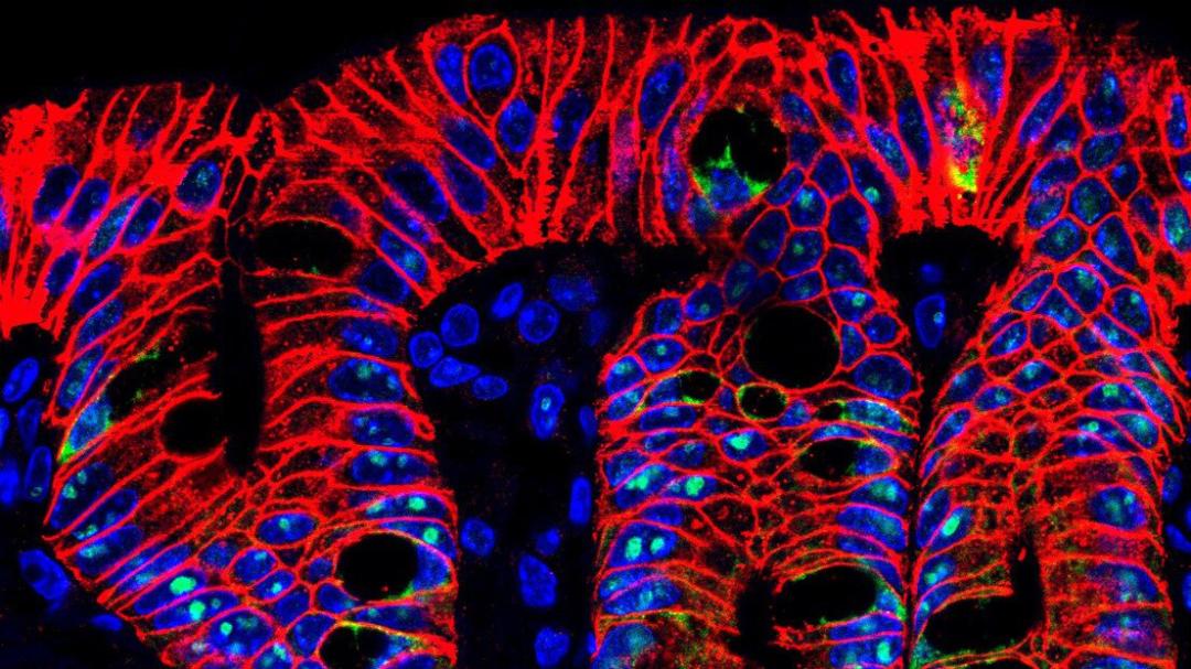 胆汁酸在肠道中的生理意义,胆汁酸能促进肠道再生吗