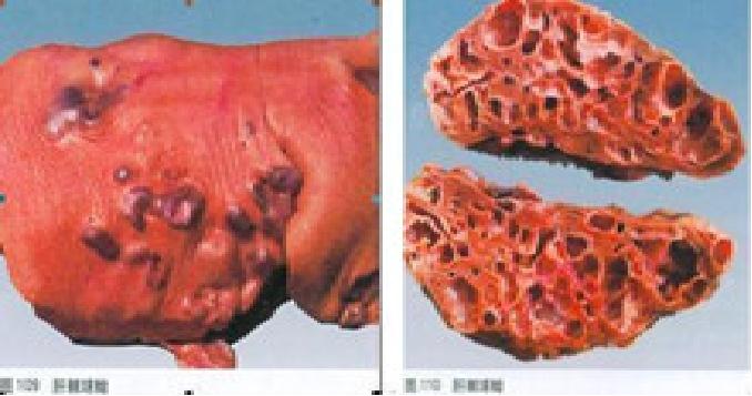 地方病防治宣传核心信息—碘缺乏病、包虫病、地方性氟中毒