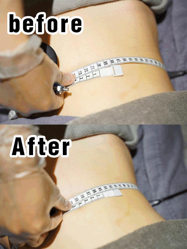 广州女生变美指南！49元抢价值3040元的美护套餐，轻轻松松就能颜值逆袭