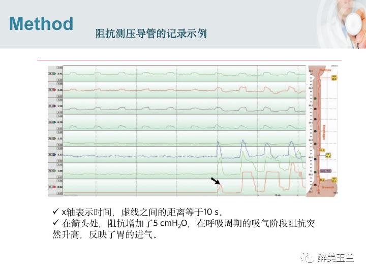 插胃管怎么用面罩吸氧,吸入麻醉时如何预防呼吸道并发症